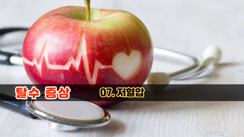07. 저혈압