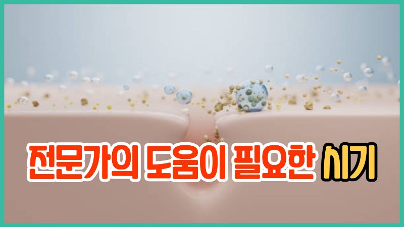 전문가의 도움이 필요한 시기